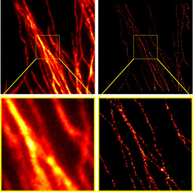 Comparison of conventional widefield microscopy and GSDIM microscopy