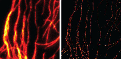 Comparison of conventional widefield microscopy and GSDIM microscopy using Chromeo 505 Goat anti-mouse IgG secondary antibody