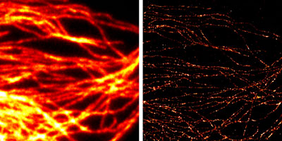 Comparison of conventional widefield microscopy and GSDIM microscopy using Chromeo 546 Goat anti-mouse IgG secondary antibody