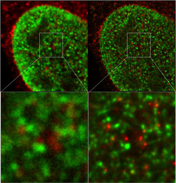 Comparison of nuclear structures visualized by dual color microscopy images with Chromeo 494 (green) and ATTO 647N fluorescent dyes using confocal and STED microscopes