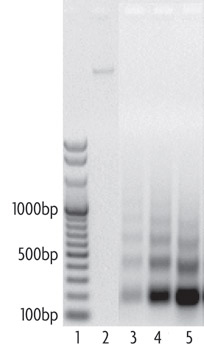 Efficiency of nucleosome digestion into mononucleosomes and oligonucleosomes