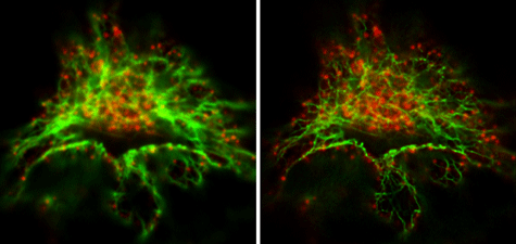 Confocal and STED microscopy images of cells co-stained with vimentin and clathrin