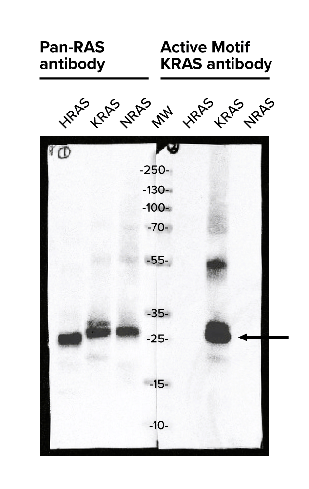 KRAS western blot