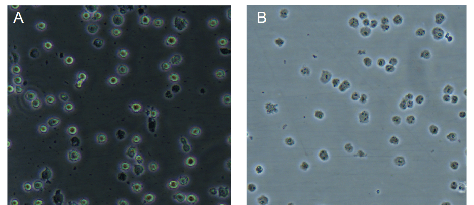 Cell lysis