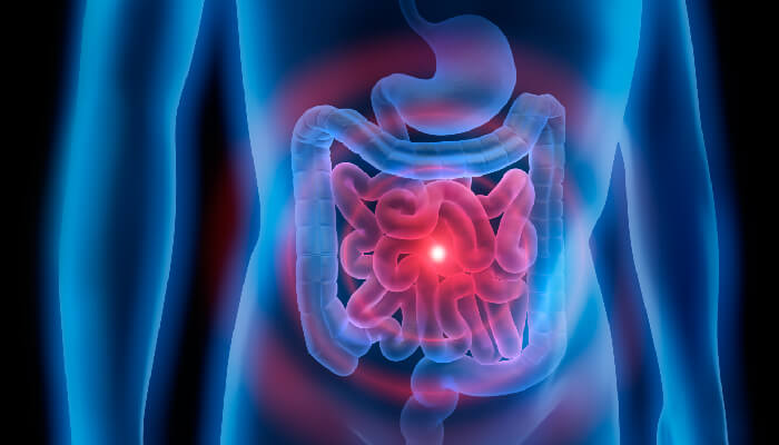 Microbiome