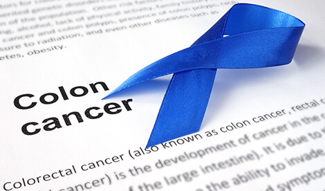 Colorectal Cancer