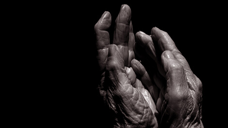 Scleroderma hands
