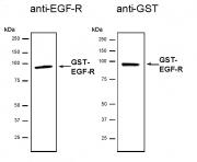 Recombinant EGFR protein analyzed by SDS-PAGE gel.