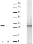 Myelin Basic Protein kinase assay