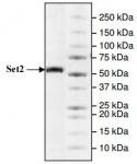 SETD2 (1418-1714) protein Coomassie gel