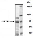 SUV39H2 protein Coomassie gel