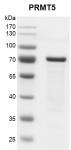 Recombinant PRMT5 protein gel.