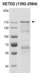 Recombinant SETD2 (1392-2564) protein gel.