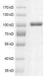 DNMT3A protein Coomassie gel