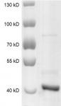 SETD8 protein Coomassie gel