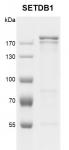 Recombinant SETDB1 protein gel