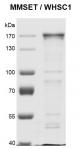 NSD2 (MMSET) Coomassie gel