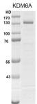 UTX / KDM6A Coomassie gel