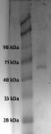 Recombinant p53 protein analyzed by SDS-PAGE gel.