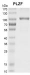 <b>Recombinant PLZF protein SDS-PAGE gel.</b>