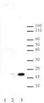Histone H2BK120ac antibody (pAb) tested by Western blot.