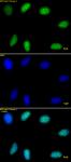 Histone H3K9me3 antibody (pAb) tested by immunofluorescence.