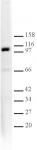 L3MBTL1 antibody (pAb) tested by Western blot.