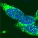 Rad51 antibody (pAb) tested by immunofluorescence.