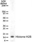 Histone H2B antibody (pAb) tested by Western blot.