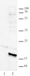 Histone H3K14bz antibody (pAb) tested by Western blot.