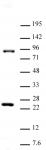Suz12 antibody (pAb) tested by Western blot.