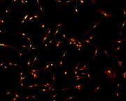NF-1A antibody (pAb) tested by immunofluorescence.