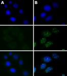 ATM phospho Ser1981 antibody (mAb) tested by immunofluorescence.