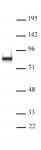L3MBTL2 antibody (pAb) tested by Western blot.