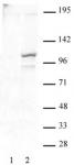 STAT2 phospho Tyr689 antibody (pAb) tested by Western blot.