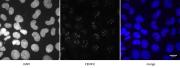 CENP-E antibody (mAb) tested by immunofluorescence.