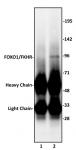 FOXO1/FKHR antibody (pAb) tested by immunoprecipitation.