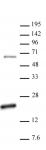 Histone H3R17me2a (asymmetric) antibody (pAb) tested by Western blot.