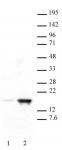 Histone H3K18ac antibody (pAb) tested by Western blot.