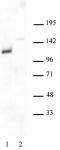 Androgen Receptor antibody (pAb) tested by Western blot.
