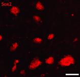 Sox2 antibody (pAb) tested by immunofluorescence.
