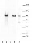 Boris / CTCFL antibody (pAb) tested by Western blot.
