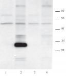 AID antibody (mAb) tested by Western blot.