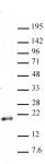 Histone H3K79me2 antibody (pAb) tested by Western blot.