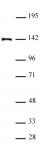 SALL4 antibody (pAb) tested by Western blot.