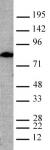 Lamin A, mature antibody (mAb) tested by Western blot.
