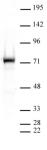 PRMT5 antibody (pAb) tested by Western blot.