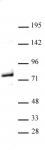 Menin antibody (pAb) tested by Western blot.