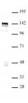 BRD8 / SMAP2 antibody (pAb) tested by Western blot.