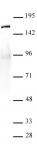 SMC1-α antibody (pAb) tested by Western blot.